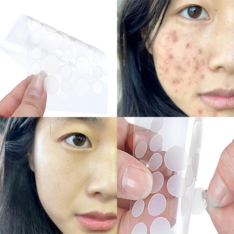 Set 36 Miếng Dán Hỗ Trợ Giảm Mụn Ban Đêm