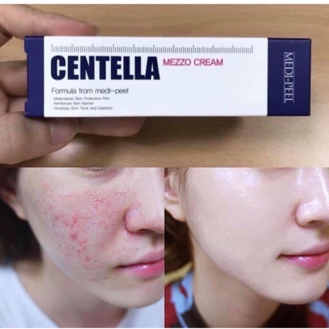 Kem dưỡng trị mụn Medipeel Centella Mezzo Cream, cam kết hàng đúng mô tả, chất lượng đảm bảo, an toàn cho sức khỏe người sử dụng