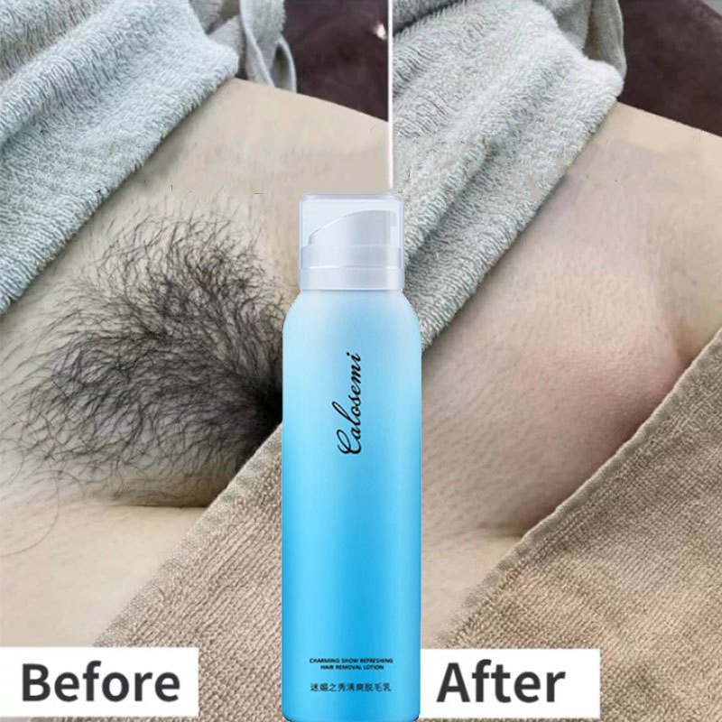 Xịt Tẩy Lông Không Gây Đau Tóc Tay 150Ml Đùi Nách Bộ Phận Riêng kem tẩy lông vùng kín tẩy lông nách