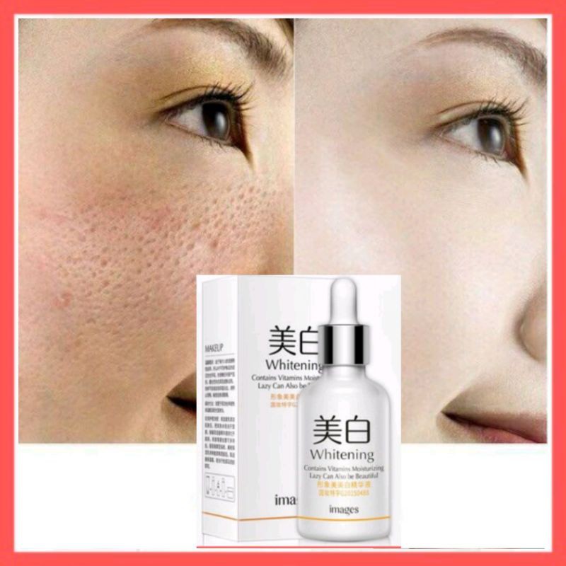 Serum mờ sẹo rỗ sẹo mụn sẹo thâm lâu năm