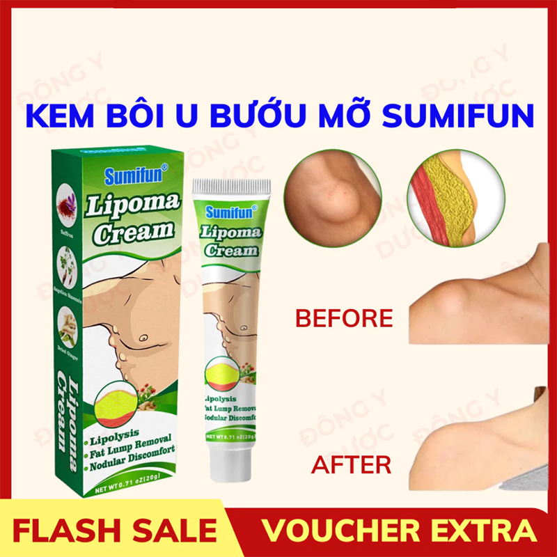 Kem Bôi Tan Sumifun Lipoma Đánh Tan U Mỡ Giảm Sưng Đau Do U Mỡ Thành phần tự nhiên 20g