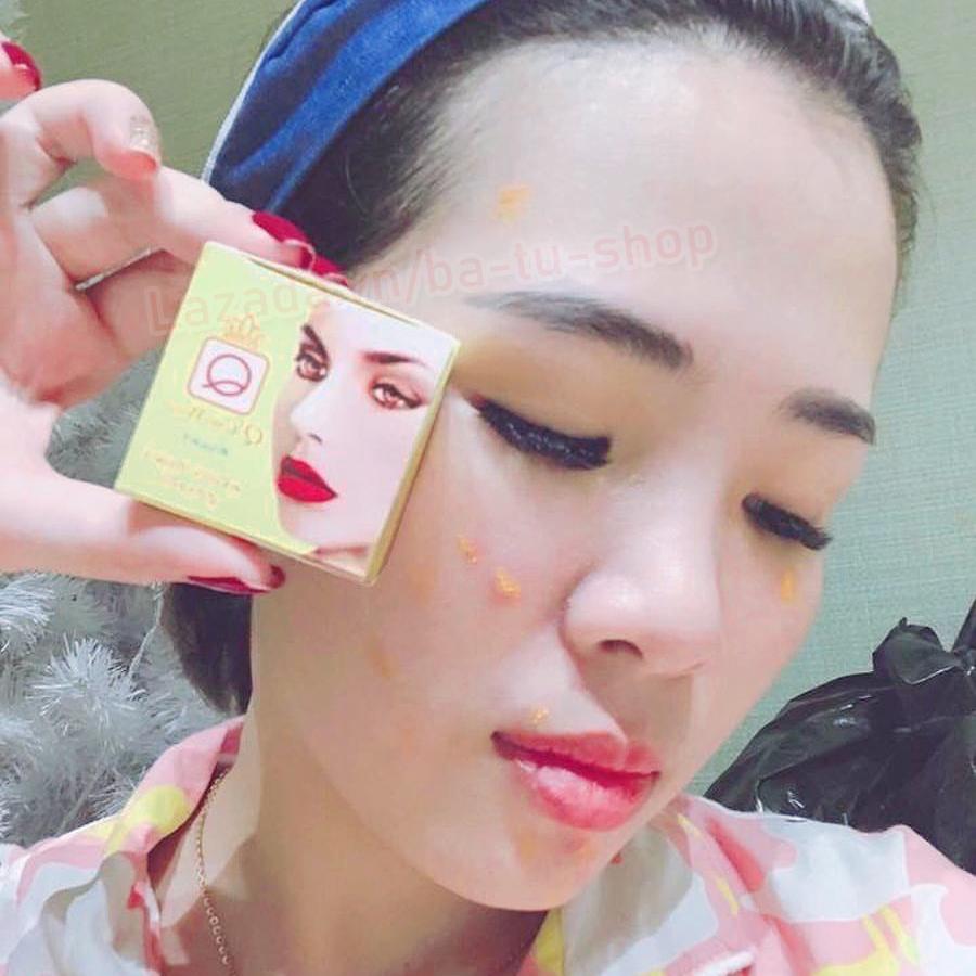 Kem giảm mụn, Dưỡng Da Nghệ Q Care White giảm mụn Thái Lan Hiệu Quả Cao chính hiệu