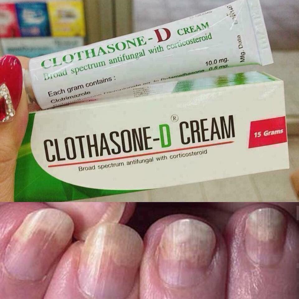Kem bôi nấm móng tay chân clothasone-d -- thái lan