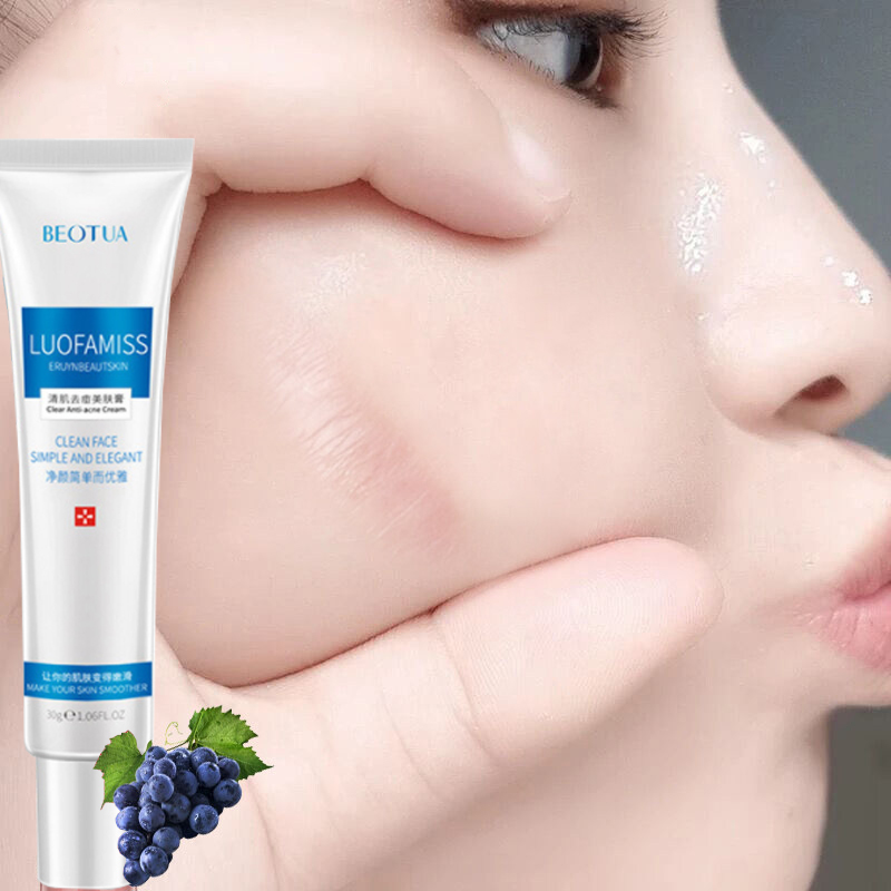 100% nguyên bản, kem phục hồi sẹo, kem xóa sẹo rạn da, [50ml] trị vết thâm mụn kem trị sẹo mụn đầu đen thu nhỏ lỗ chân lông, làm trắng, dưỡng ẩm, kiểm soát dầu chăm sóc da mặt