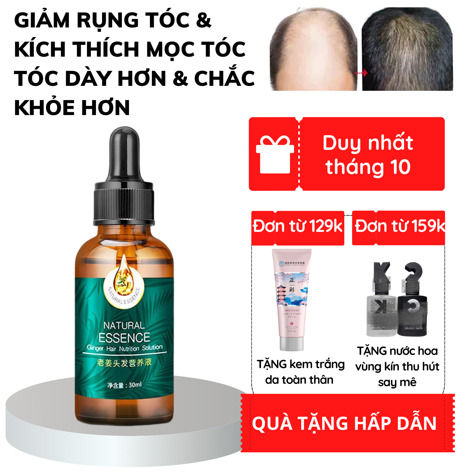 Tinh chất siêu mọc tóc nhanh chỉ sau 7 ngày serum dưỡng tóc/kích thích mọc tóc nhanh làm dày Chiết xuất hoàn toàn từ thiên nhiên / không có tác dụng phụ / giúp giảm rụng tóc / giải quyết vấn đề rụng tóc do lão hóa / hói đầu sau sinh