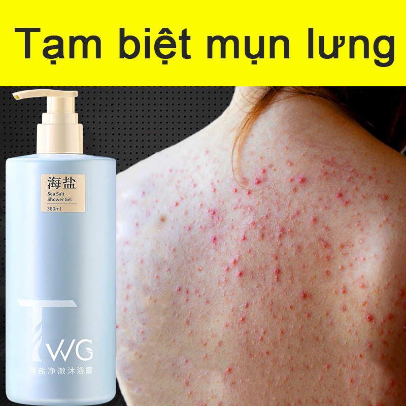 Sữa tắm xóa mụn làm trắng 7 ngày xóa mụn Sữa tắm Loại bỏ lớp sừng Làm trắng mịn da Loại bỏ hắc tố Giảm ngứa Sữa tắm muối biển