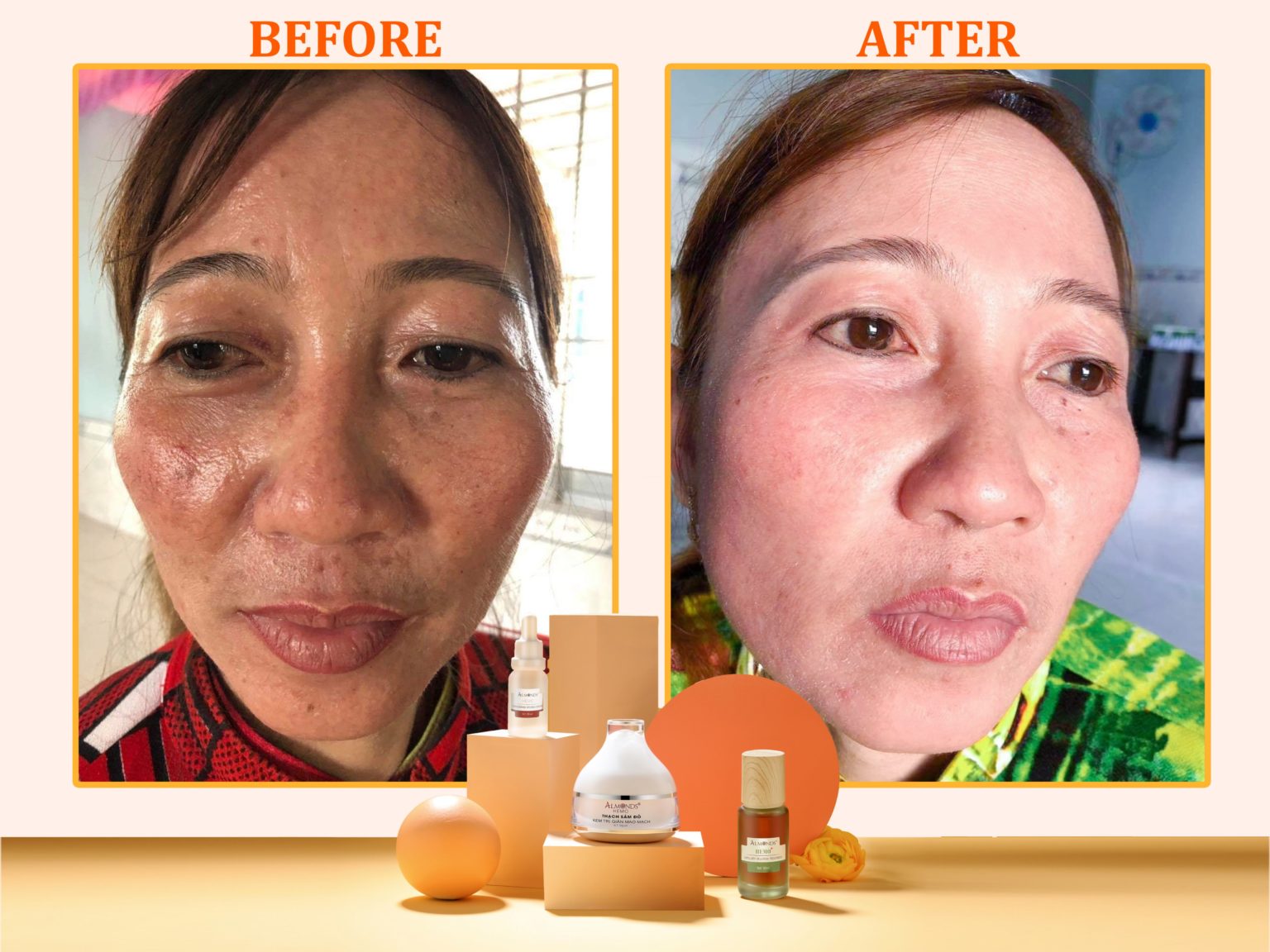 [HCM]KEM TR.I. GIÃN MAO MẠCH - THẠCH SÂM ĐỎ