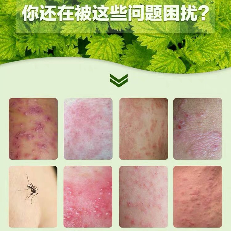 Kem bôi ngoài da HUOJIANDUI YiJun Rugao 18gr chuyên hỗ trợ giảm nấm các loại hắc lào vảy nến á sừng nưt ne ngứa ngoài da TOP 10 LOẠI kem bôi ngoài da tốt nhất Trung Hoa 2