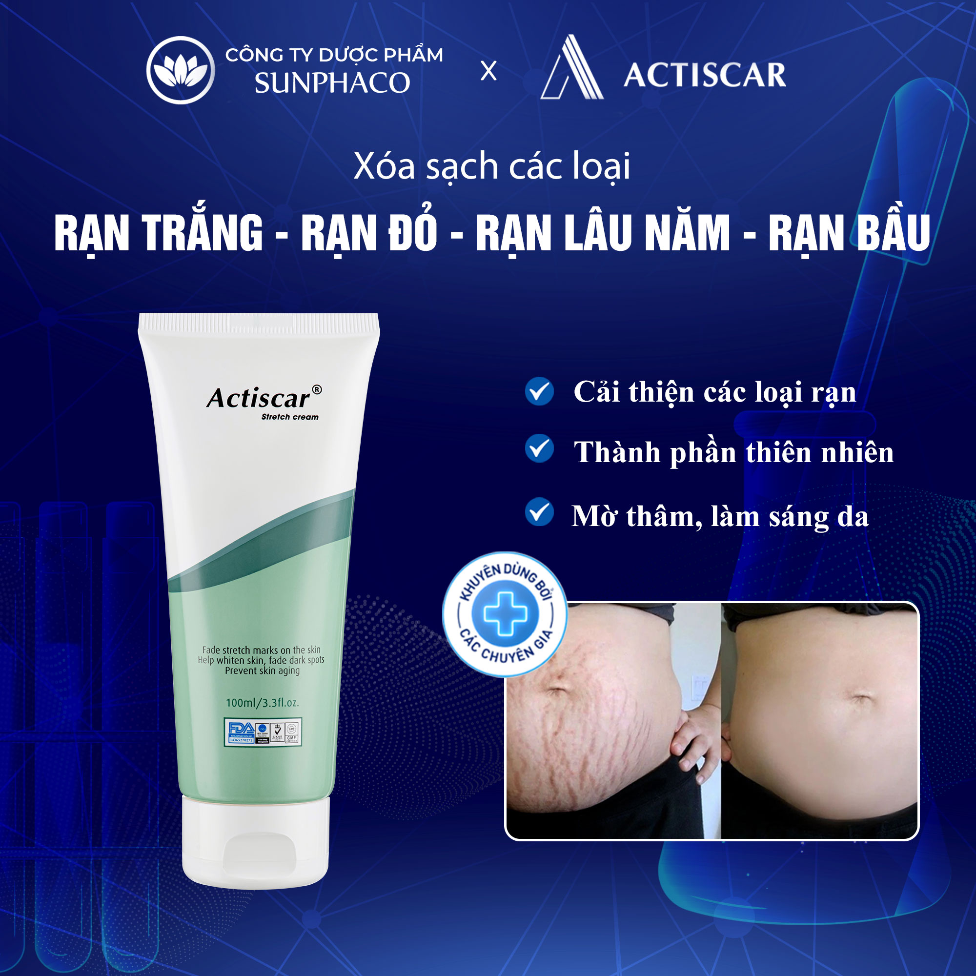 Kem rạn da làm mờ rạn trắng, rạn đỏ actiscar xóa sạch rạn bà bầu, rạn do tăng cân, dậy thì, rạn lâu năm
