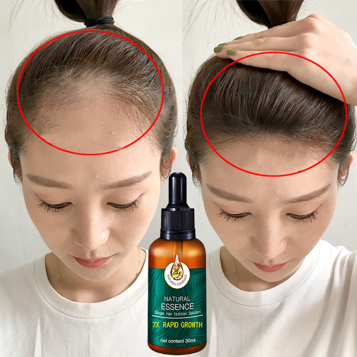 Dầu dưỡng tóc tinh dầu chăm sóc tóc Tinh chất mọc tóc Tinh chất gừng tươi Chống rụng tóc 30ml nước dinh dưỡng tóc gừng