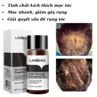 Tinh Chất Kích Thích Mọc Tóc, Dưỡng Tóc Chuyên Sâu, Ngăn Ngừa Gãy Rụng, Giải Quyết Các Vấn Đề Về Da Đầu, Đẩy Nhanh Quá Trình Mọc Tóc, Tăng Cường Dinh Dưỡng Cho Chân Tóc