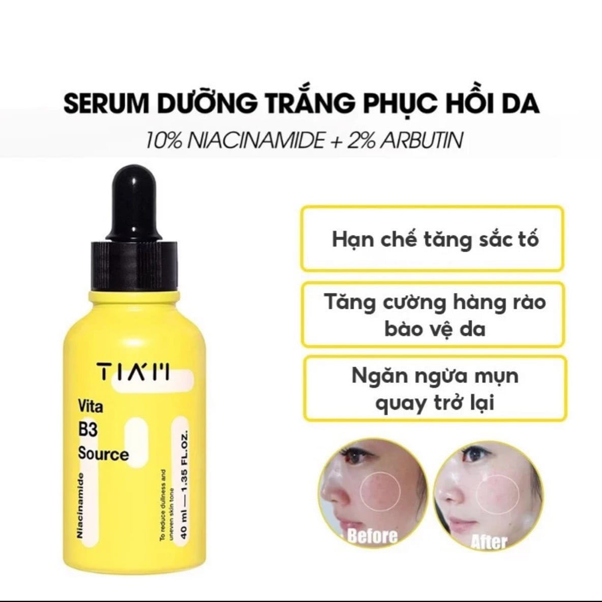 Serum TIA'M Dưỡng Sáng, Phục Hồi Cho Da Dầu Mụn, Nhạy Cảm Niacinamide 10% + Arbutin 2% Tia'm Vita B3 Source 40ml
