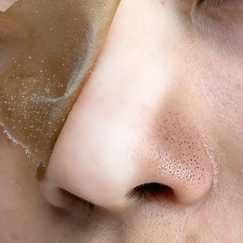 👍Gel lột mụn đầu đen than hoạt tính giúp hút mụn cám mụn đầu đen, mặt nạ lột mụn mũi tẩy tế bào chết vệ sinh da mặt thu nhỏ lỗ chân lông Làm sạch lỗ chân lông loại bỏ mụn đa tác dụng