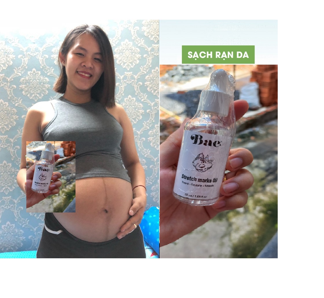 Tinh Dầu ngăn ngừa rạn da cho bà bầu
