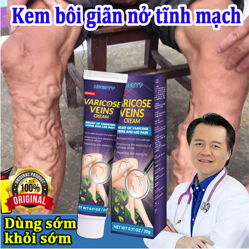 Kem giãn tĩnh mạch giúp lưu thông tĩnh mạch giãn tĩnh mạch chân làm dịu đau đớn Loại bỏ sưng mạch máu tay chân phồng gân xanh kem bôi suy giãn tĩnh mạch chân