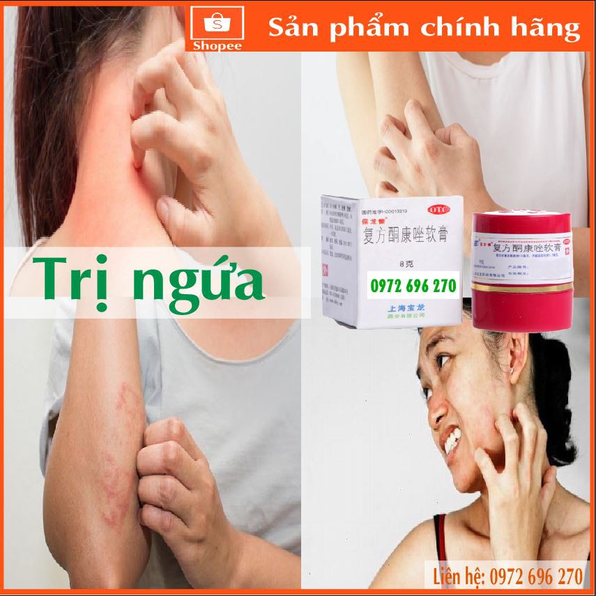 Kem bôi ngứa ; mẩn ngứa mề day - cực hiệu quả