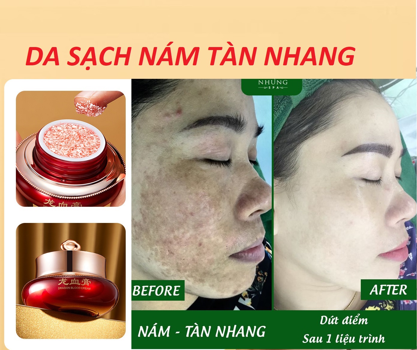 kem đánh bay nám tàn nhang chống lão hóa da nâng cơ  được chiết suất từ thiên nhiên an toàn và hiệu quả sau 1 liệu trình ngắn