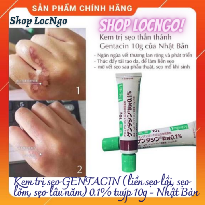 [Freeship]Kem xóa sẹo GENTACIN - Nhật Bản (liền sẹo lồi, sẹo lõm, sẹo lâu năm) 0.1% tuýp 10g  by Shop LocNgo