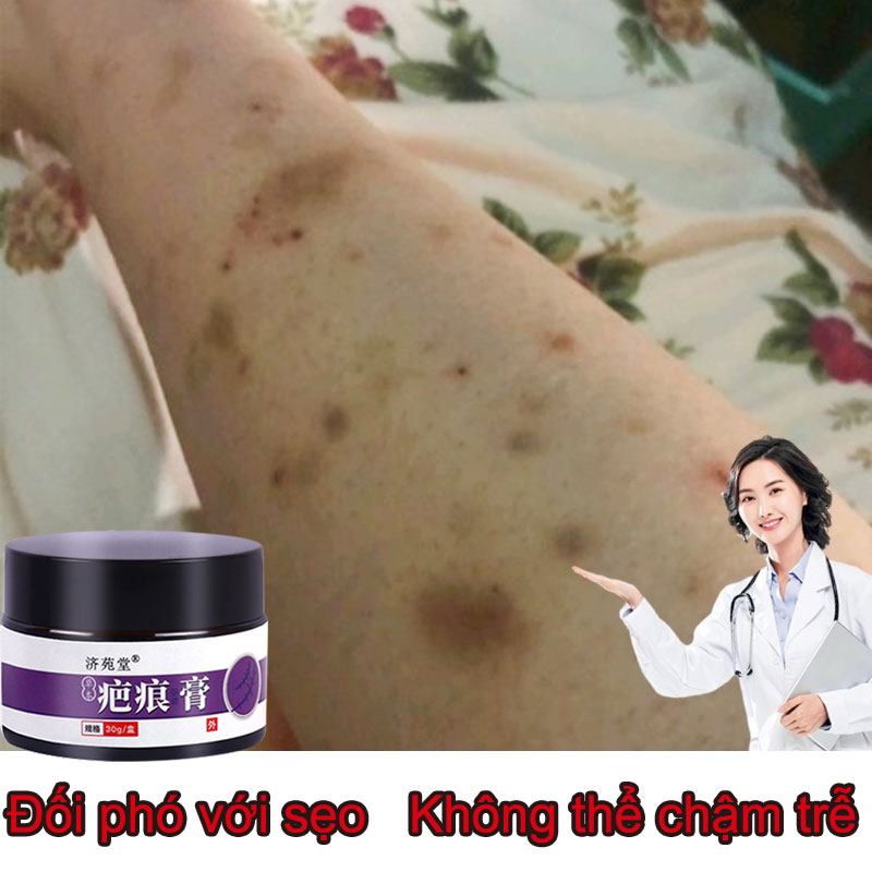 Kem xóa sẹo sửa chữa sẹo và vết rạn da sẹo cũ 30g kem phục hồi sẹo sau sinh mổ