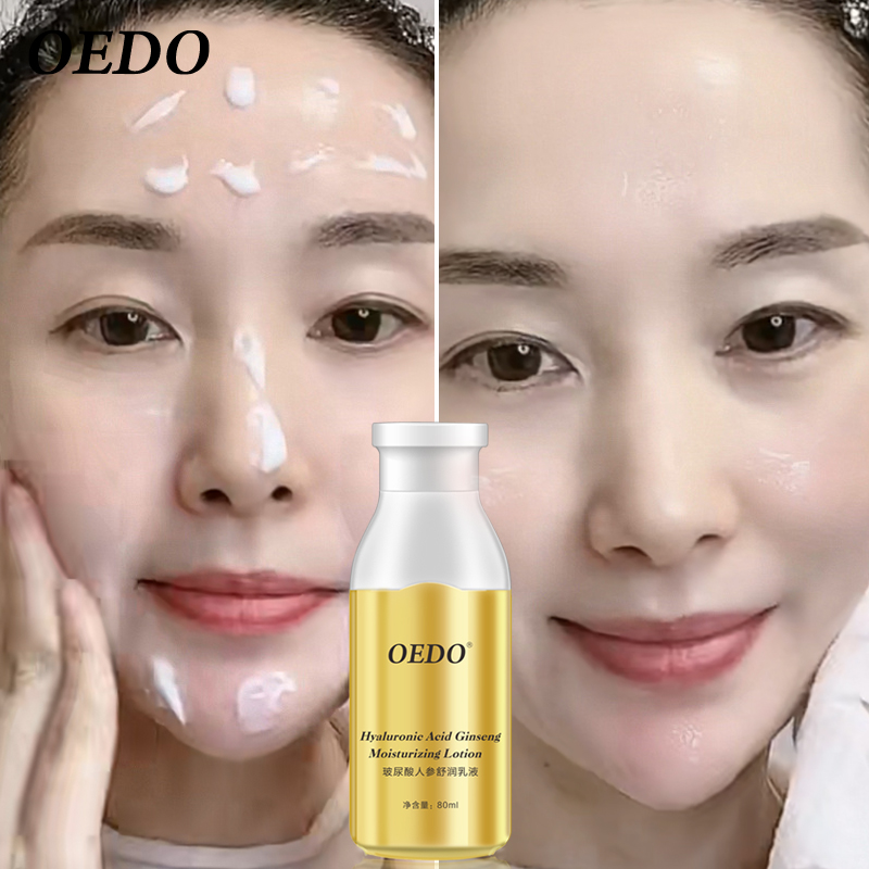 OEDO Kem dưỡng ẩm nhân sâm chứa Hyaluronic Acid chăm sóc da làm trắng điều mụn và kiểm soát dầu - INTL