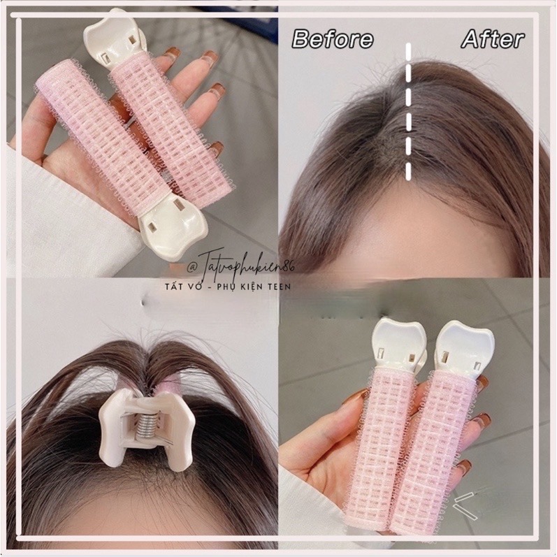 Kẹp phồng mái - Kẹp phồng tóc - Kẹp phồng tóc mái - Hàn quốc kẹp tóc phồng tự nhiên như hàn quốc