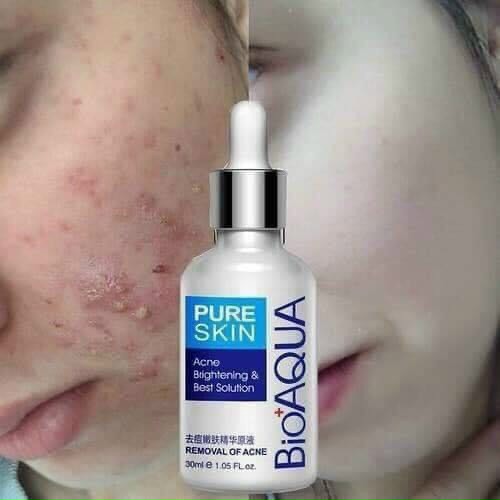 Serum mụn bioqua