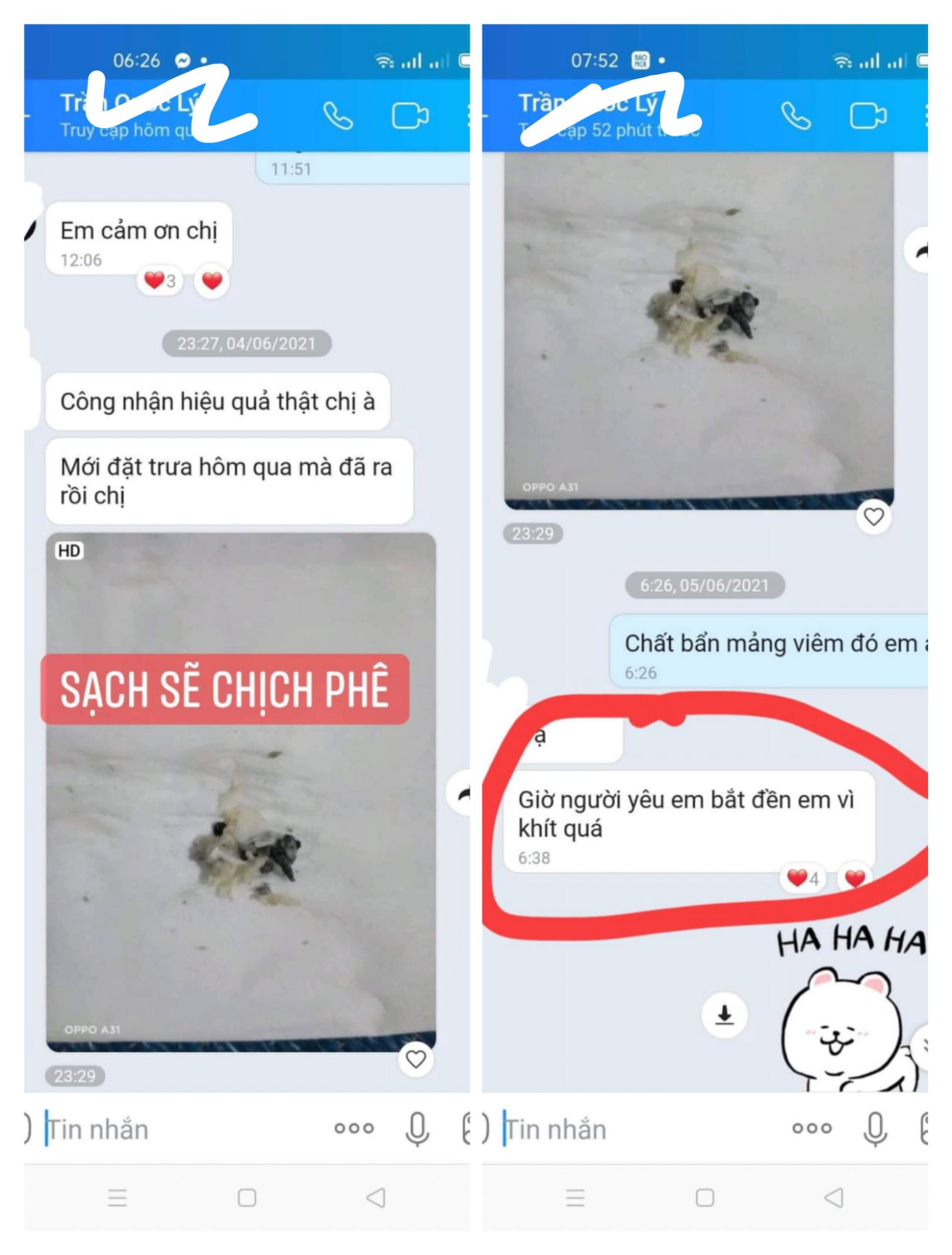 Viên Đặt Se Khít Vùng Kín Briar