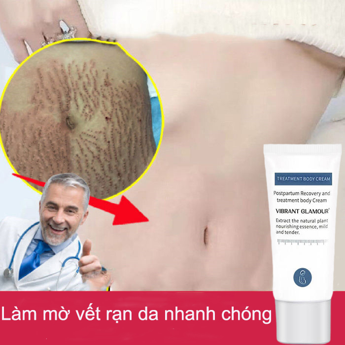 Kem Làm Mờ Rạn Da Sau Sinh, Mờ Thâm, Xoá Vết Rạn Da, Cải Thiện Da Có Khuyết Điểm Giảm Thâm, kem phục hồi làm săn chắc da, làm mờ vết rạn da cho sản phụ sau sinh 30g