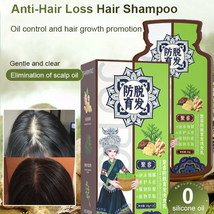 Ginger shampoo, anti-hair loss, hair growth, hair care