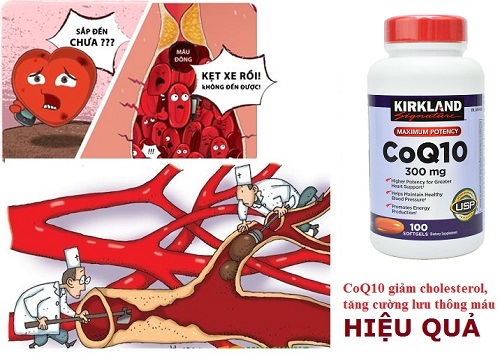 Viên coq10 kirkland 300mg 100 viên mỹ