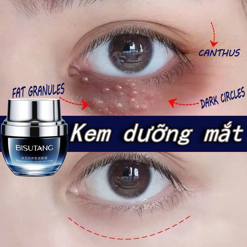 Dưỡng ẩm kem mắt Kem dưỡng mắt Xóa thâm quầng mắt và tinh chất chống lão hóa mắt Kem dưỡng mắt chống nhăn 30g bảo vệ mắt kem dưỡng trắng mắt Kem Dưỡng Trắng Da Dưỡng Ẩm Giảm Quầng chống bọng mắt loại bỏ nếp nhăn