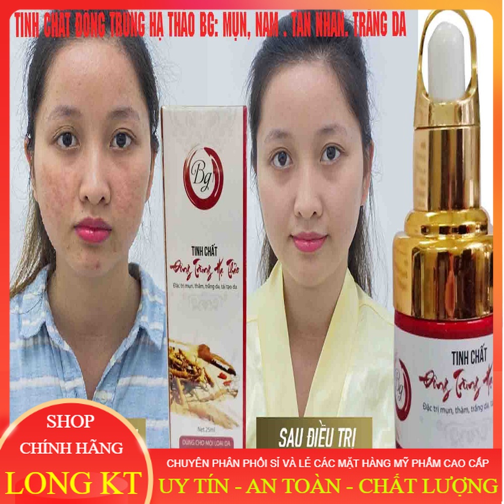 [Mỹ phẩm Chính hãng ]: Tinh Chất Đông Trùng Hạ Thảo BG 25ml Mụn Bọc – Mụn Viêm – Mụn Ẩn – Mụn Nặng