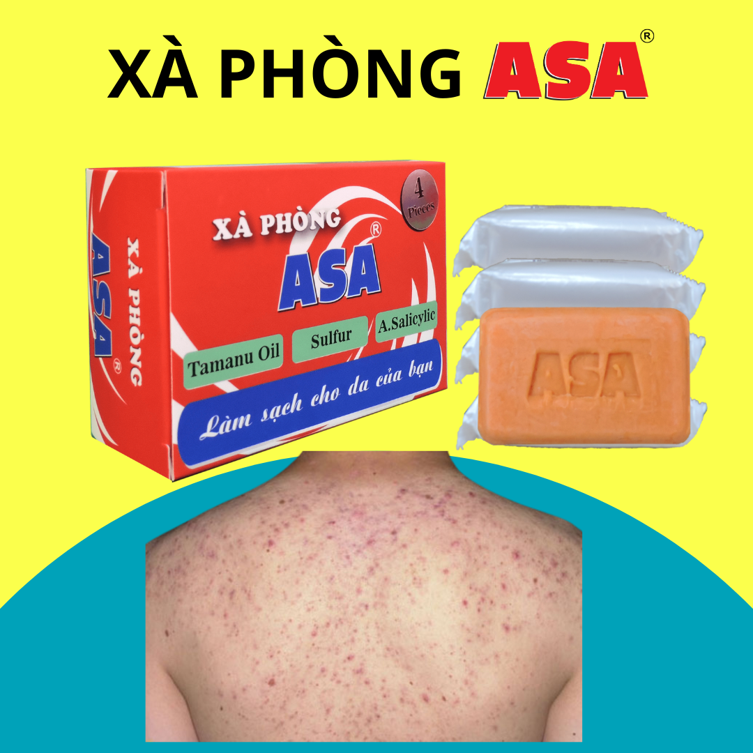 Xà phòng ASA 120g - Kháng khuẩn, hạn chế ngăn ngừa mụn, làm sạch gàu