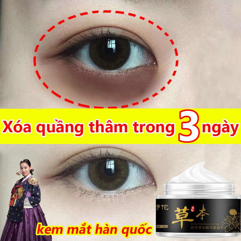 Kem dưỡng mắt chống nhăn xóa thâm quầng mắt và tinh chất chống lão hóa mắt 30g Giảm Thâm Nếp Nhăn Bọng,Làm săn chắc da ,xóa túi mắt các hạt mỡ mắt đi