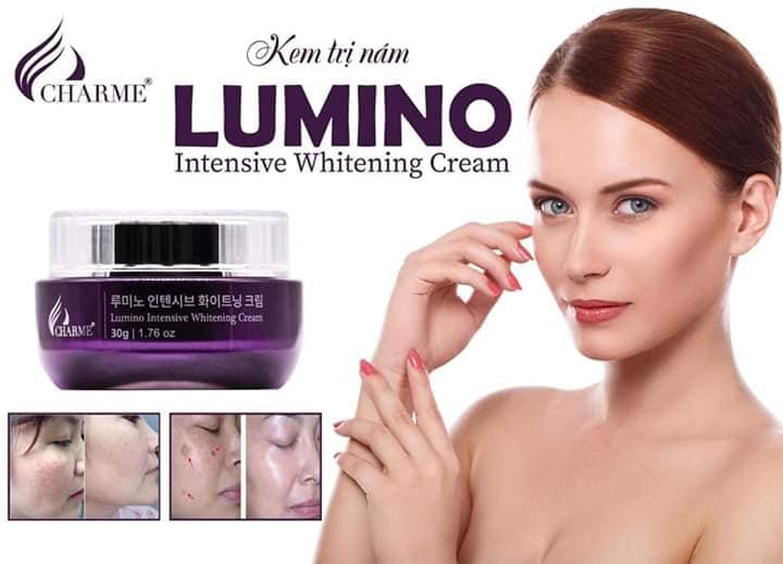 Kem ngừa nám trắng da charme_lumino hàn quốc 30g