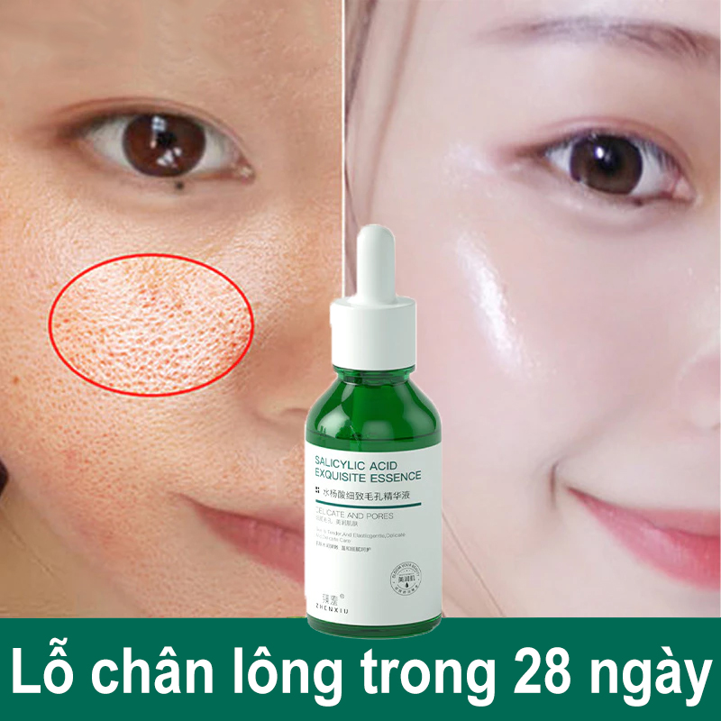 Serum thu nhỏ lỗ chân lông chứa axit salicylic xe khít lỗ chân lông lỗ chân lông to se khít lỗ chân lông da mặt serum se khít lỗ chân lông se khít lỗ chân lông 30ml