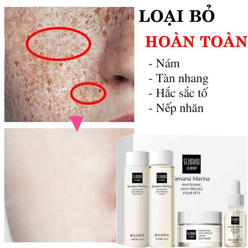 Bộ 4 sản phẩm dưỡng da chuyên sâu Senana marina làm trắng ,xóa tàn nhang dưỡng ẩm sâu ,bộ 4 sản phẩm gồm toner ,tinh chất, sữa dưỡng da, kem dưỡng da