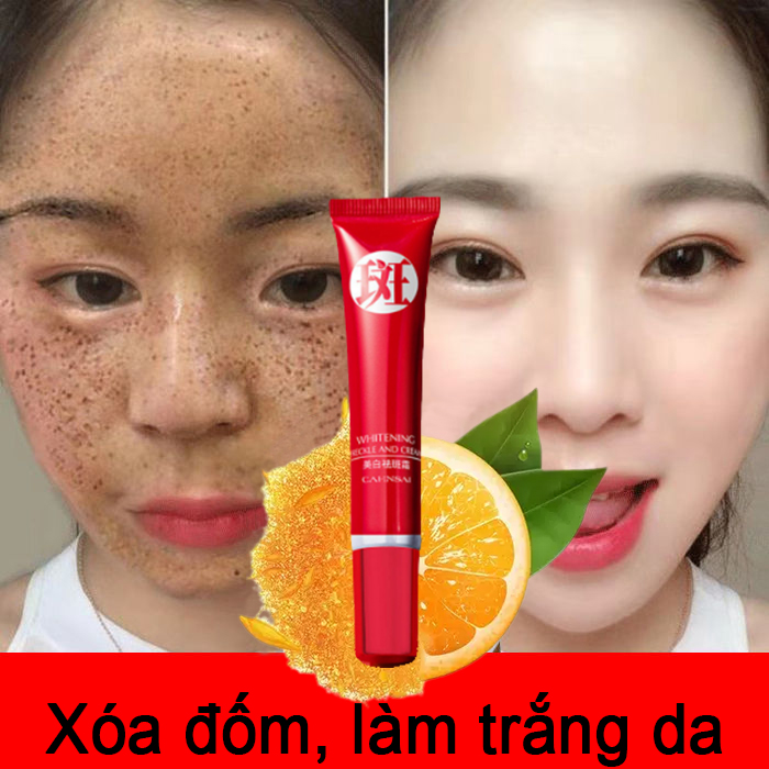 (Xóa tàn nhang trong 7 ngày) Kem làm trắng da và xóa tàn nhang hiệu quả giúp loại bỏ các vết nám, mụn, thâm, sắc tố melanin, dưỡng ẩm cho da 20g, Cải thiện tình trạng sạm da, chống lão hóa, giúp da tươi trẻ và không bóng nhờn