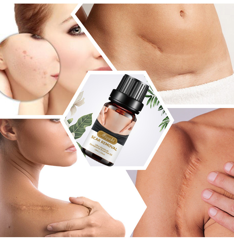 Tinh chất hết sẹo lồi lõm, sẹo sau sinh, sẹo thâm mụn, hết các loại sẹo nhanh chóng. KEM HẾT SẸO THÂM LÂU NĂM , SẸO RỖ, SẸO LỒI, SẸO LÕM, VẾT RẠN DA, SẸO THÂM SẸO PHẨU THUẬT.. - KEM SẸO THÂM