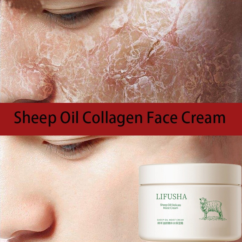 Kem Lanolin Dưỡng Ẩm Chăm Sóc Da Khô Giúp Làm Trắng Kiểm Soát Dầu,từ dầu cừu để chăm sóc da mặt da tay và cơ thể
