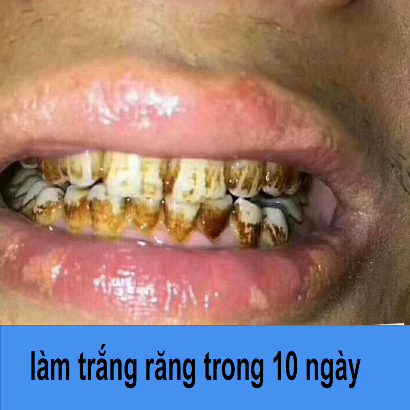 Bột Tẩy Trắng Răng Kem Răng Trắng Sạch Vệ Sinh Răng Miệng Bàn Chải Đánh Răng Gel Loại Bỏ Mảng Bám Vết Bẩn Whitening White Pearl Powder