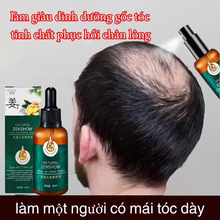 【Hàng sẵn】Mọc tóc nhanh,tinh chất gừng,chất lỏng dưỡng tóc,Ngăn ngừa rụng tóc,sửa chữa các nang tóc,thức đẩy mọc tóc,cải thiện tóc xoăn,tinh chất thảo dược 30ml
