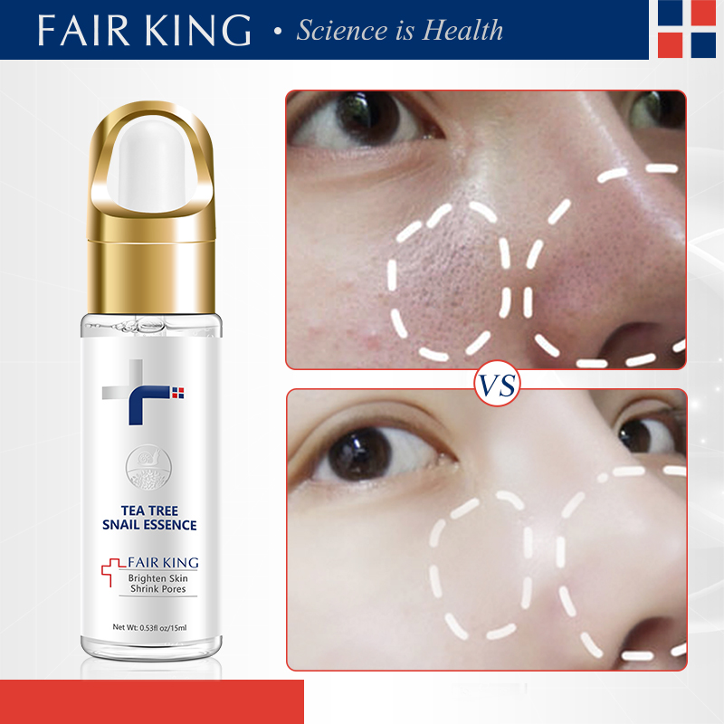 FAIR KING Serum ốc sên chống lão hóa cho mặt Kem dưỡng trắng da mặt axit hyaluronic để chăm sóc da mặt Thu nhỏ lỗ chân lông Retinol Mỹ phẩm  - intl