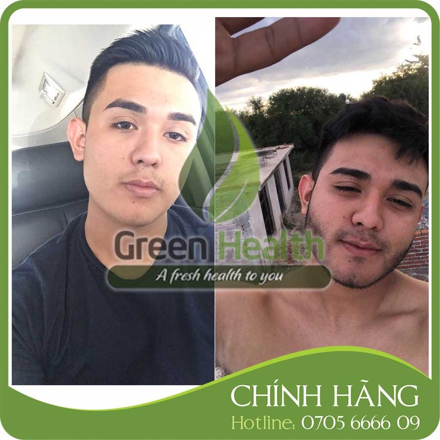 https://vn-live-01.slatic.net/p/f81da6ba0c9c34031526e58b8f9f0b8b.jpg