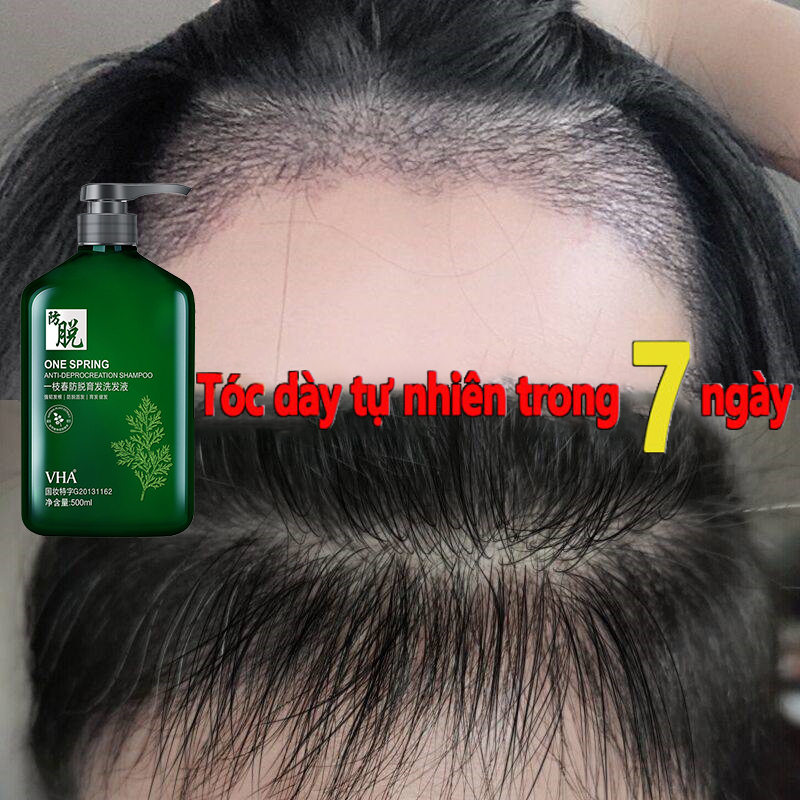 Dầu gội rụng tóc và moc tóc,dầu gội mọc tóc chống rụng tóc,Dầu gội đầu mọc tóc,dầu gội gừng mọc tóc-Kích thích mọc tóc,Ngăn rụng tóc và dưỡng tóc Kiểm soát dầu và loại bỏ mạt,giảm ngứa,Phục hồi da đầu và tóc chẻ ngọn Loại bỏ gàu