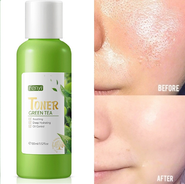 Toner trà xanh fenyi green tea se khít lỗ chân lông làm dịu da 100ml dưỡng trắng cấp ẩm kiểm soát dầu và se khít lỗ chân lông làm đều màu da