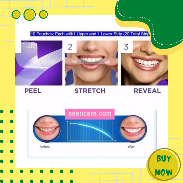 Miếng dán trắng răng Oral-B 3D White Whitestrips Úc [ CHÍNH HÃNG ] Miếng dán tẩy trắng răng an toàn - Hộp 28 miếng