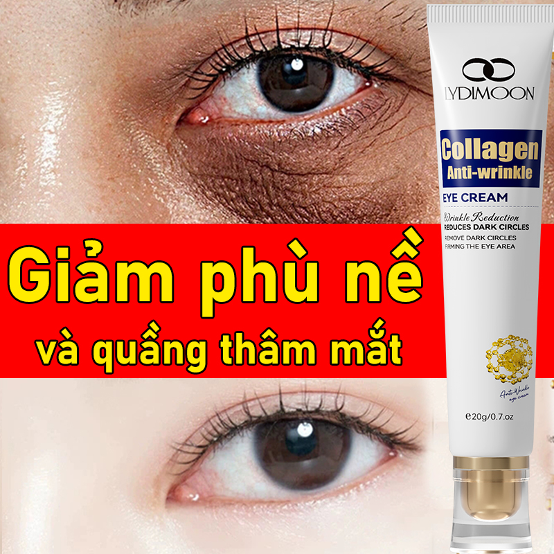 kem mắt collagen kem mắt xóa quầng thâm mắt Kem mắt cho mặt chống lão hóa săn chắc da Giảm quầng thâm, dưỡng sáng, mờ nhăn, bọng mắt, chống lão hóa