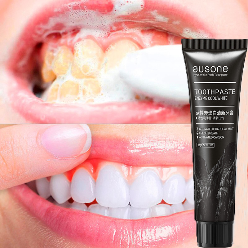 Mua 2 tặng 1 kem đánh răng baking soda Kem đánh răng làm trắng răng Kem Đánh Răng Bảo Vệ Răng Chắc Khỏe,Giảm Ê Buốt,Sâu Răng giúp giảm hôi miệng, sạch lưỡi, hết sâu răng 85g