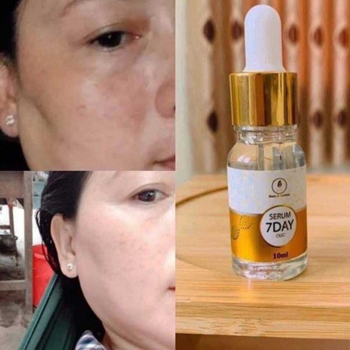 Y - COMBO 3 CHAI SERUM HUYẾT THANH TRUYỀN TRẮNG OLIC 7DAY DƯỠNG DA TRẮNG SÁNG MỀM MỊN